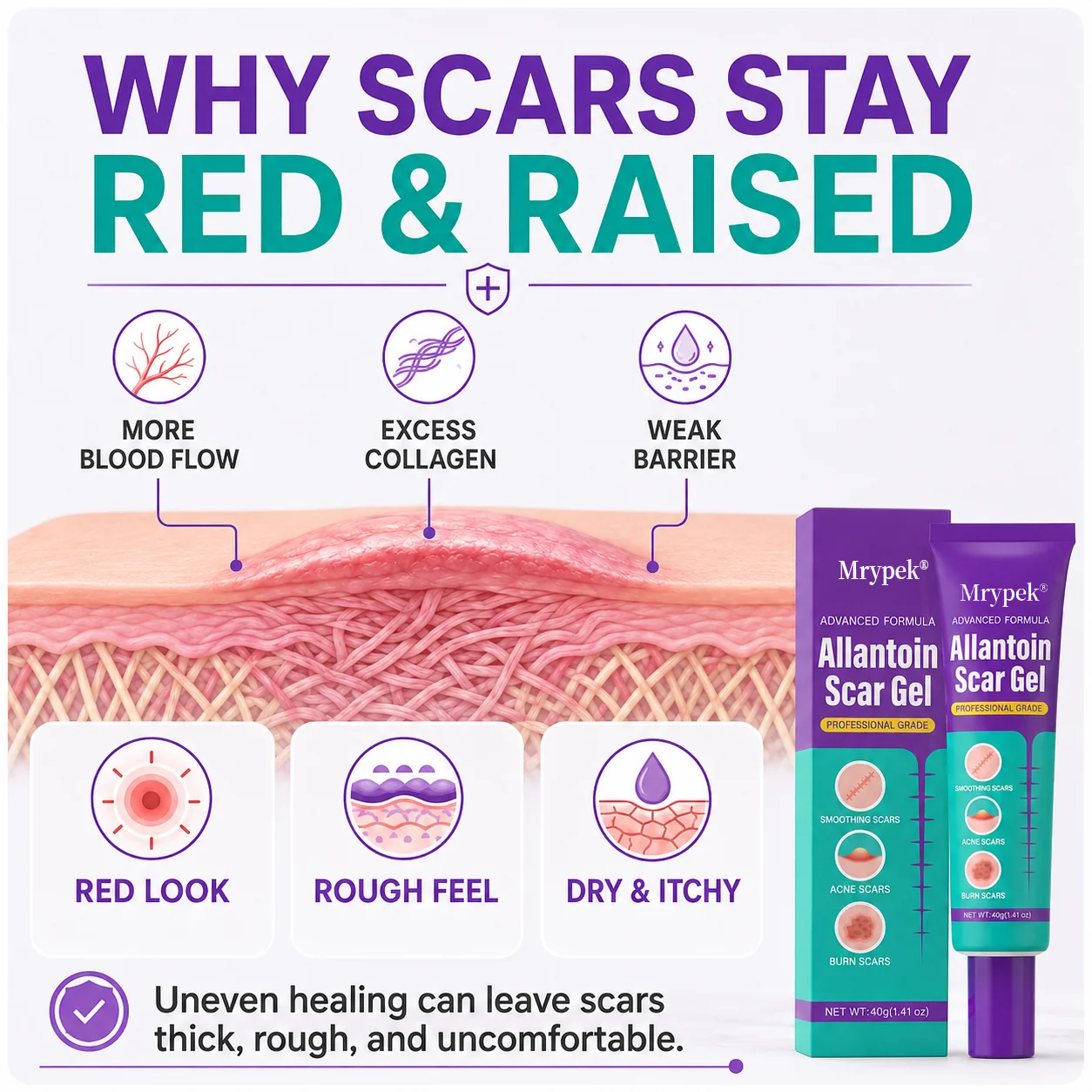 Mrypek® Allantoin Scar Gel- limited-time discount